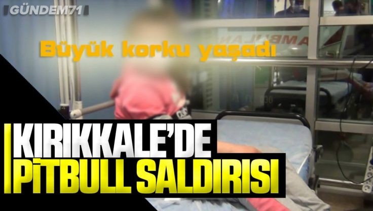 Kırıkkale’de Minik Çocuk Evlerinin Önünde Pitbull Saldırısına Uğradı