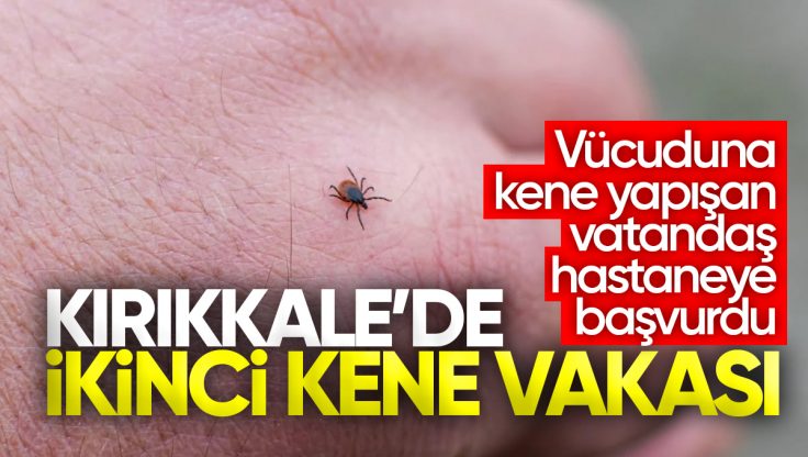 Kırıkkale’de İkinci Kene Vakası; Vücuduna Kene Yapışan Vatandaş Hastaneye Başvurdu