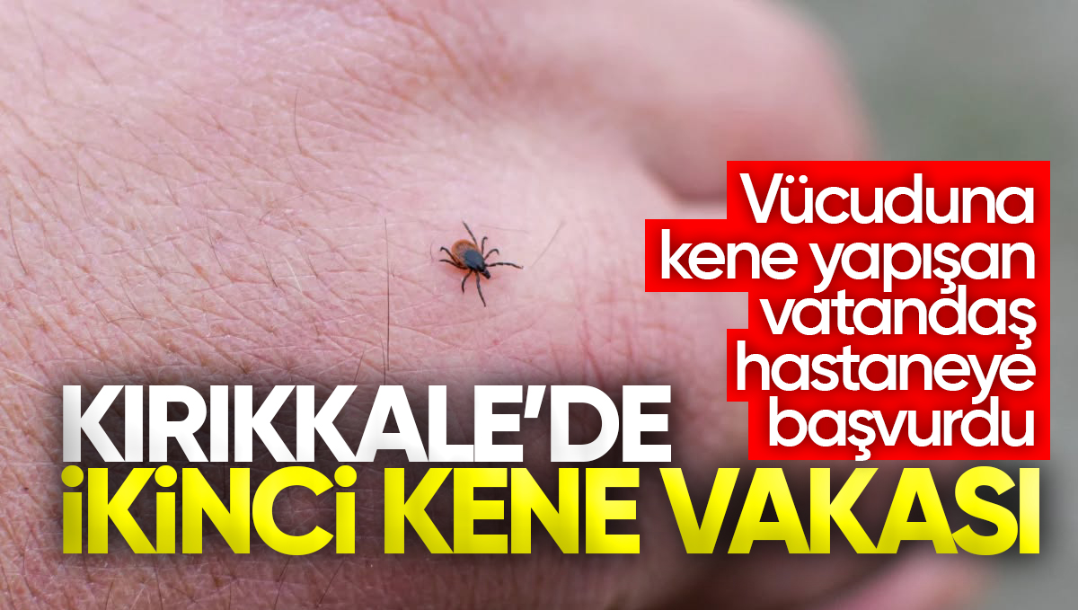 Kırıkkale’de İkinci Kene Vakası; Vücuduna Kene Yapışan Vatandaş Hastaneye Başvurdu