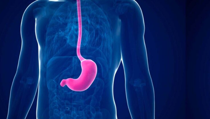 Mide Balonu Fiyatları Neye Göre Değişir? Tedavi Süreci ve Maliyet Detayları