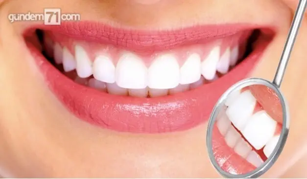 Neden Diş Teli Kullanmalıyız?